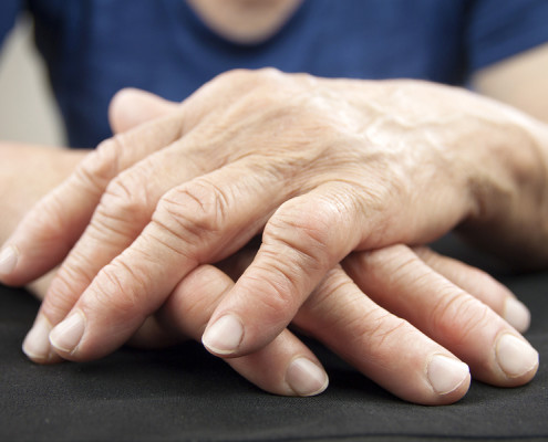 How Regular Massage Can Relieve Arthritis Pain